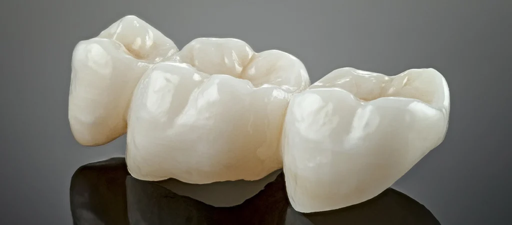 metal-free-ceramic-dental-crowns-2022-12-20-16-37-08-utc